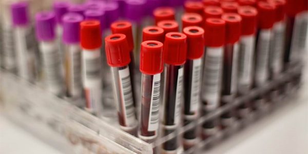 Blood-Samples-1